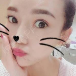 明星眼睛手术,揭秘明星眼睛手术的神奇魅力